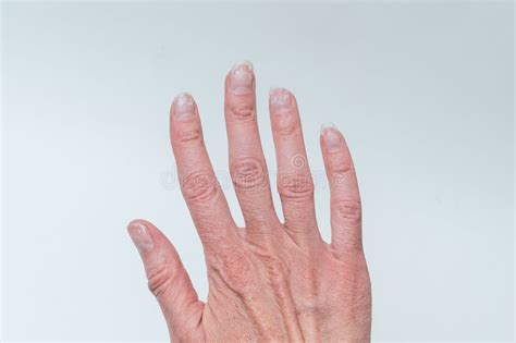 Close-up of a Woman& X27;s Age-old Hand with Wrinkles with Natural ...