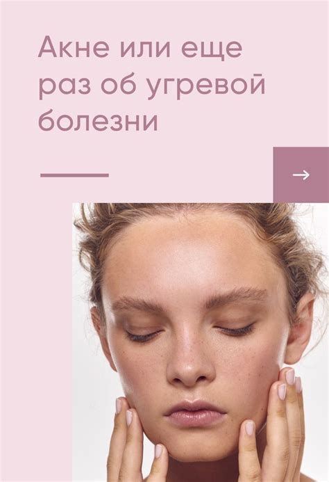 Акне или еще раз об угревой болезни