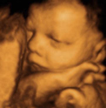 3d Ultrasound Pregnancy :: 3d Puzzle Image