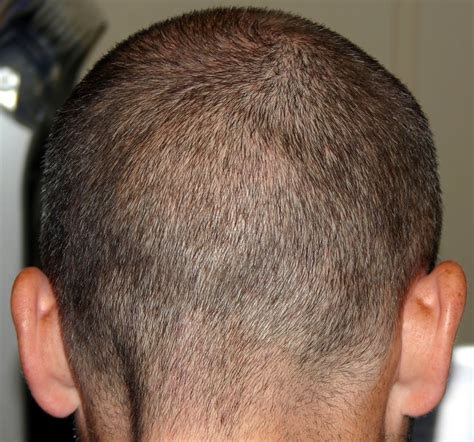 Head Free Photo Download | FreeImages
