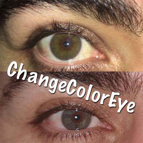 permanent eye color change 10