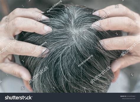 3,714 Damage Hair Men Images, Stock Photos & Vectors | Shutterstock