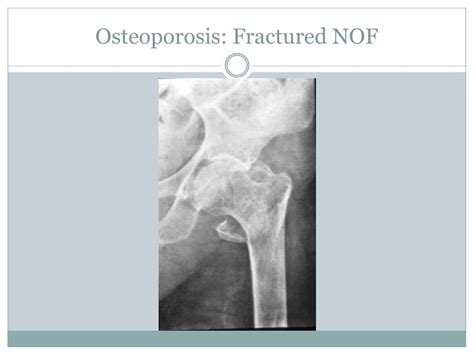 introduction  orthopaedics powerpoint  id