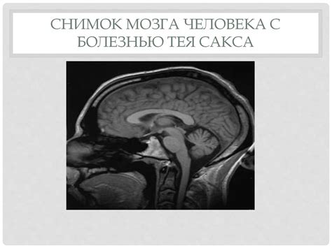 Семейная амавротическая идиотия - презентация онлайн