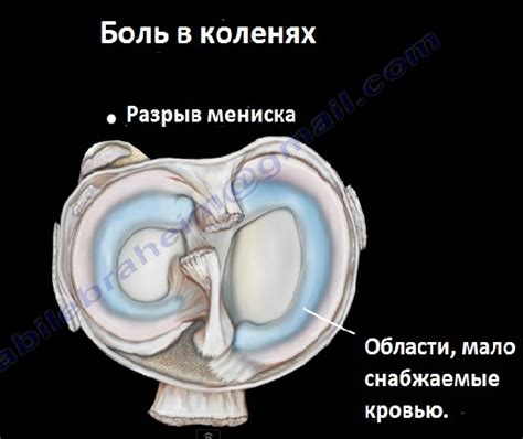 Боль в коленях или почему лотос не цветет? | Минский йога клуб Yoga 108