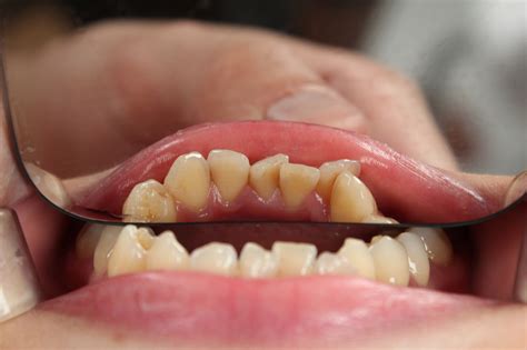 Clínica Dental en las Rozas de Madrid Todas las especialidades | ⭐ ⭐ ⭐ ⭐ ⭐