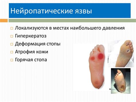 Хронические осложнения сахарного диабета - презентация онлайн