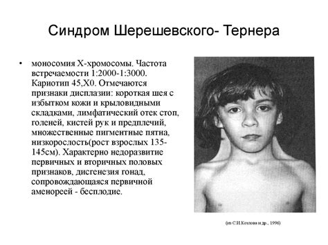Хромосомные синдромы - презентация онлайн