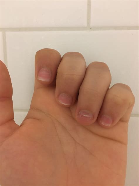 how to get acrylics off 5