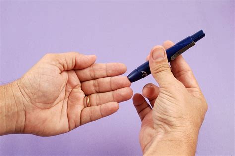 Rizartroza - artroza palčevega sklepa - Medicofit