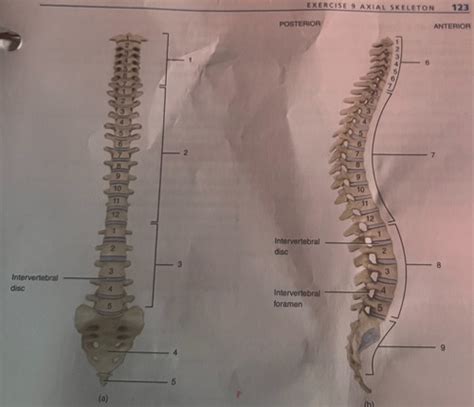 ANATOMY SPINE Flashcards | Quizlet
