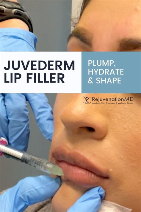 Full lips with stunning juvederm lip filler – Artofit