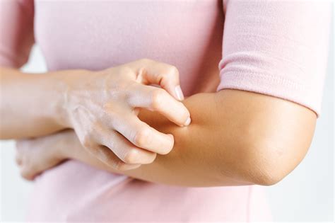 Себорейный дерматит - лечение в Киеве | Brennerclinic