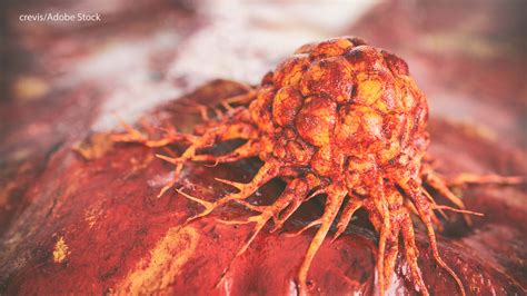 Frequency and Outcomes of Brain Metastases in Patients With HER2-Mutant