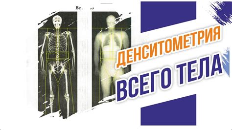 Денситометрия. Измеряем жир, мышцы и кости с точностью до грамма - YouTube