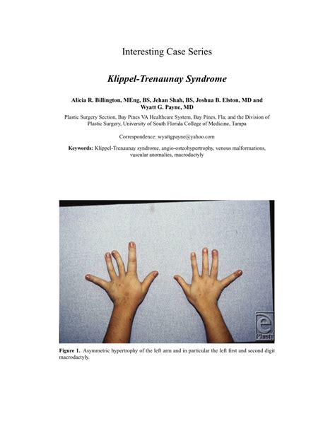 (PDF) Klippel-Trenaunay Syndrome