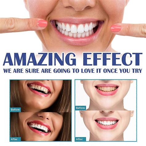 2x Soothing Antiseptic Gel Treatment Inflamed Gums Mouth Tissue ...