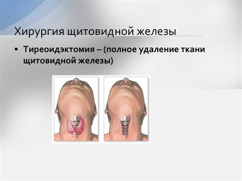 Щитовидная железа. Строение и функции - презентация онлайн