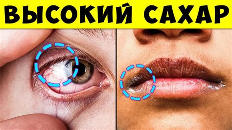17 признаков того, что ваш Уровень Сахара в Крови Слишком Высок ...