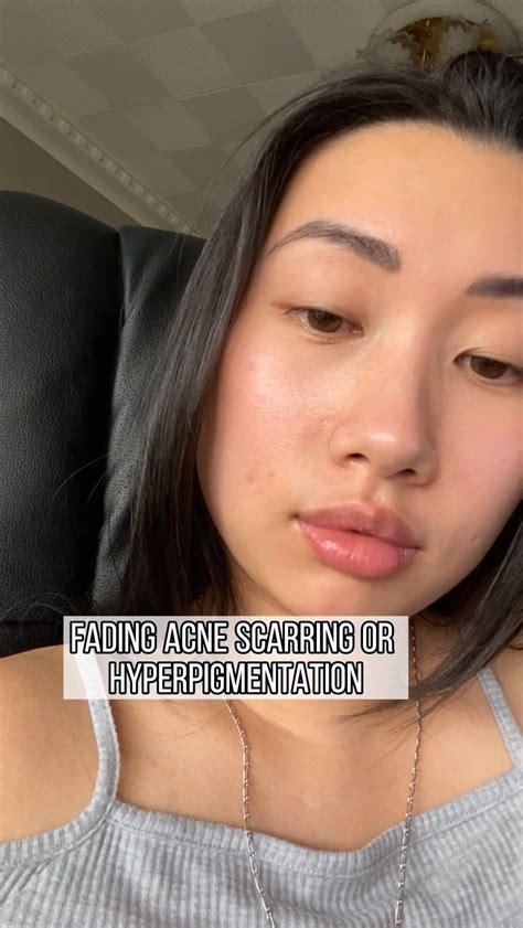 SKIN W/ WENDY (@skinwithwendles) • Instagram photos and videos