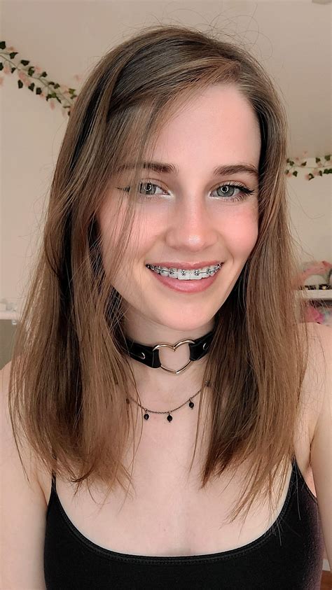 Your daily dose of braceface😋 | Scrolller