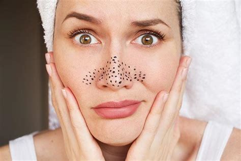 The Unbelievable Blackhead Removal Secret Celebrities Don't Want You to Know - nw83zo7