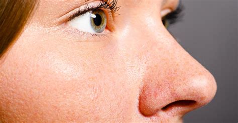 Cellulitis symptoms nose. Nasal Vestibulitis: Symptoms, Causes, and ...