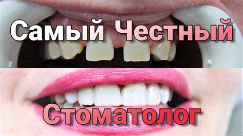 Самый Честный Стоматолог - YouTube