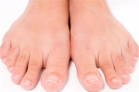 Ноготь на ноге отходит - Modnail.ru - Красивый маникюр