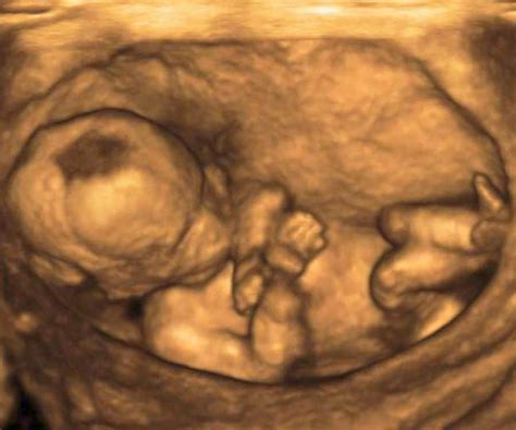 Ultrasound Image Gallery Near Me in Shrewsbury, NJ