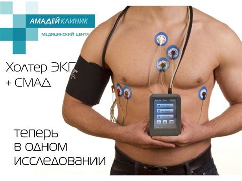 Смад: что это за обследование, цена обследования и расшифровка результатов