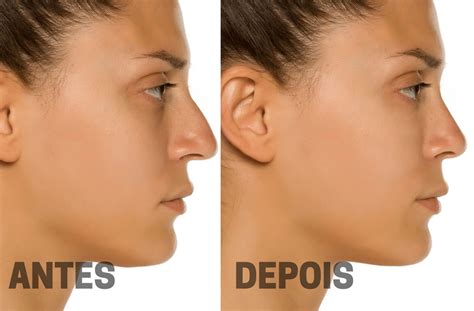Apelido Para Nariz Grande Pesado - Apelidos Para Quem Tem O Nariz Grande - RETOEDU