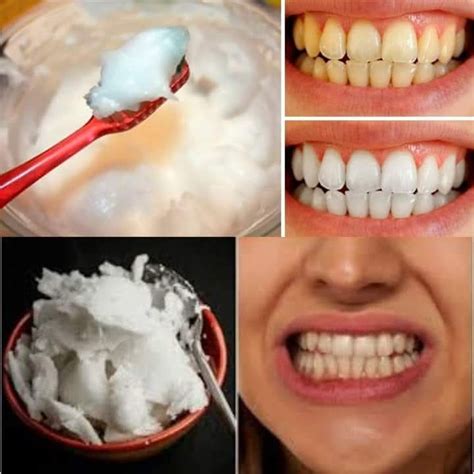 naturally whiten  teeth  home    minutes