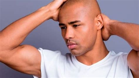Dia Mundial Do Careca - Notícias | Dia mundial do careca: 7 fatos pouco conhecidos sobre a ...