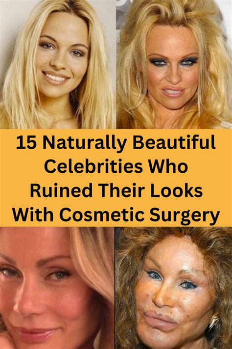 15 Naturally Beautiful Celebrities Who Ruined Their Looks With Cosmetic ...