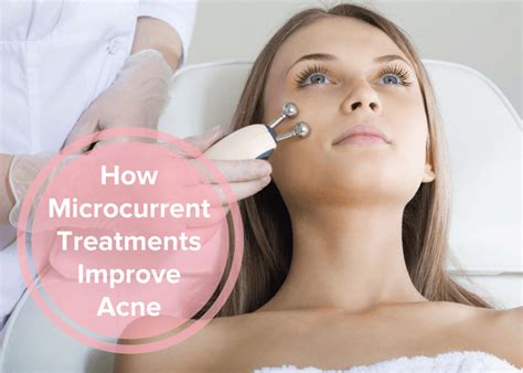 How Microcurrent Treatments Improve Acne - Envision Skin Care Center ...