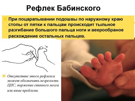 Новорожденный ребенок. Особенности периода новорожденности ...