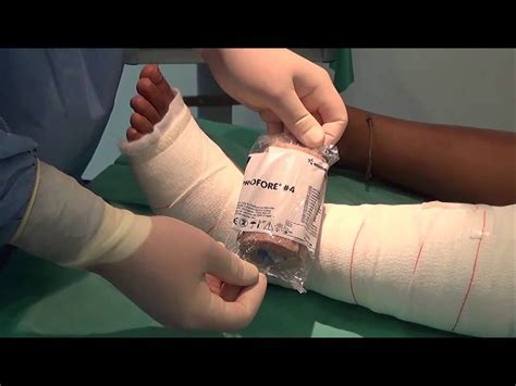 PROFORE Anwendungsvideo - YouTube