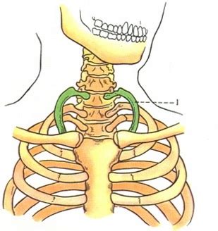 Thorax / Редкие формы деформации грудной клетки / Добавочное шейное ребро