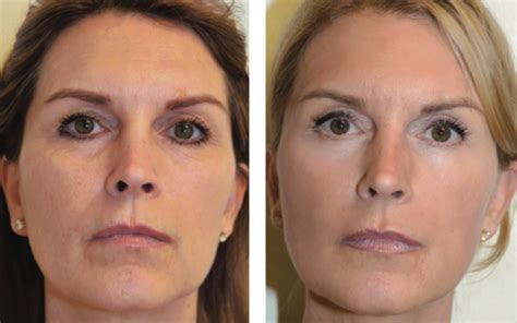 Skin Treatments in Mt Juliet & Lebanon TN | The Lett Center