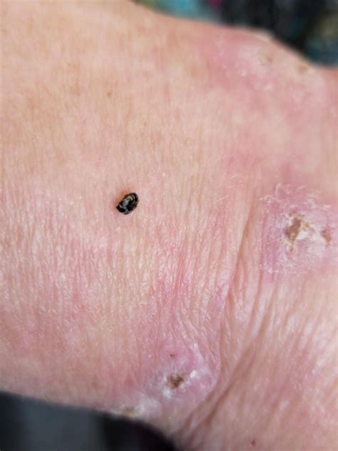 Carpenter beetles or bed bug? : r/Bedbugs