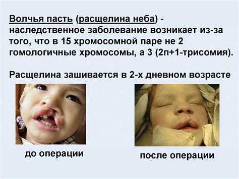 Наследственная изменчивость. Типы мутаций. (11 класс) - презентация онлайн