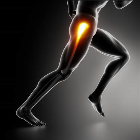 Greater Trochanteric Pain Syndrome – IONA Physiotherapy | Physiotherapy ...