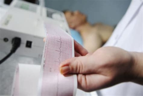 Ecodopplercardiograma: o que é, para que serve e como é feito