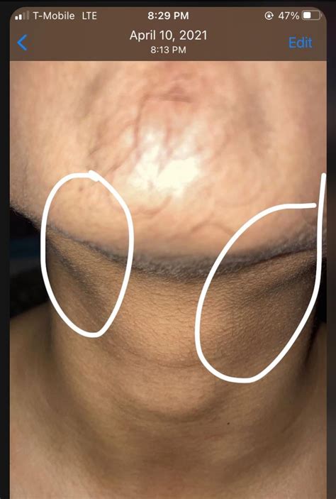 lymph nodes vs Submandibular glands : r/Mewing