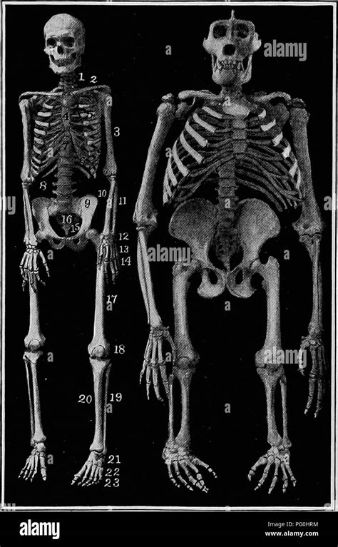 Cervical vertebrae 7 hi-res stock photography and images - Alamy