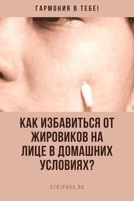 [37+] Жировик на лице фото