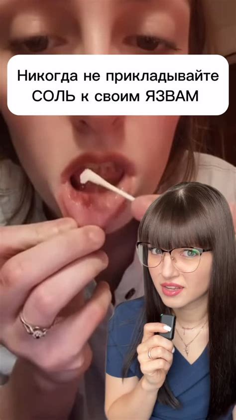 Екатерина Смирнова | Почему нельзя грызть ногти: 4 веские причины ...