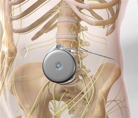 pain pump  pain pump institute