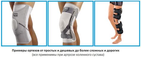 Наколенники при артрозе коленного сустава – как выбрать?